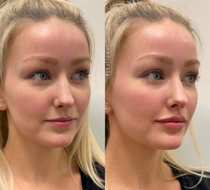 before-after